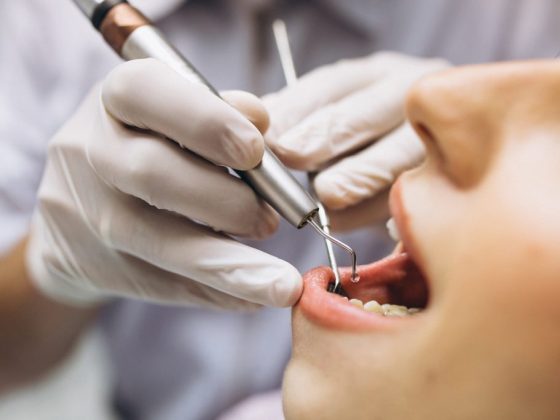 Abceso dental